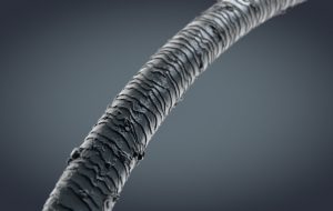 haartransplantatie