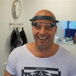 Haartransplantatie Andy van der Meijde