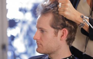 haartransplantatie dun haar